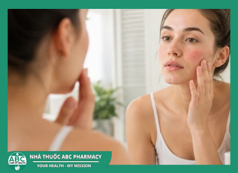 Dị Ứng Mỹ Phẩm Phải Làm Sao? Hướng Dẫn Xử Lý Đúng Cách